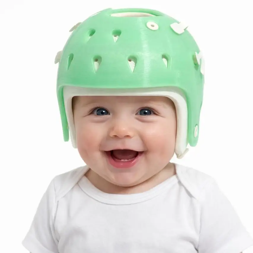 casco craneal